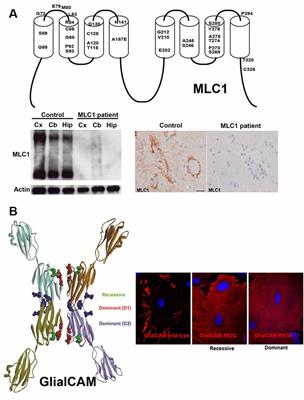 Megalencephalic Leukoencephalopathy: Insights Into Pathophysiology and Perspectives for Therapy